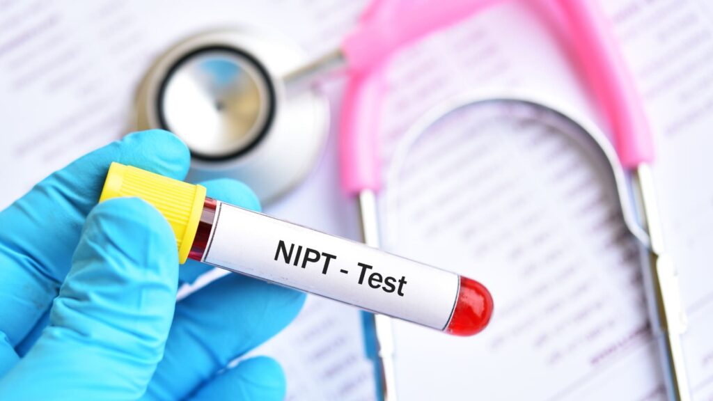בדיקת NIPT