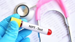בדיקת NIPT